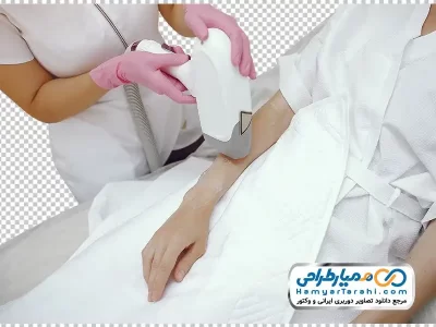 تصویر png خانم در حال لیزر موهای دست