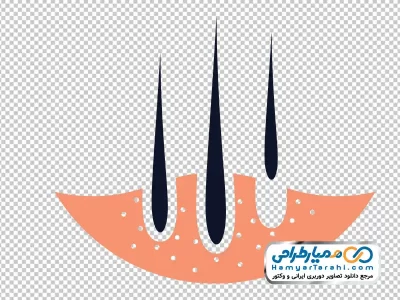دانلود عکس وکتوری کاشت مو