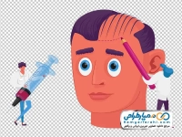عکس وکتوری سر در حال کاشت مو